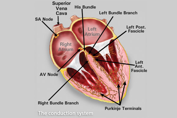 ECG - I