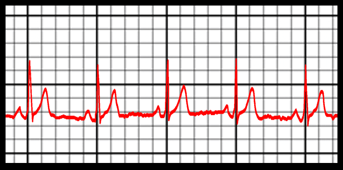 Cardio_R06_2022